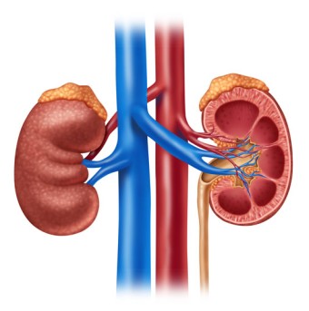 Kidney Transplant by OrangeCountySurgeons